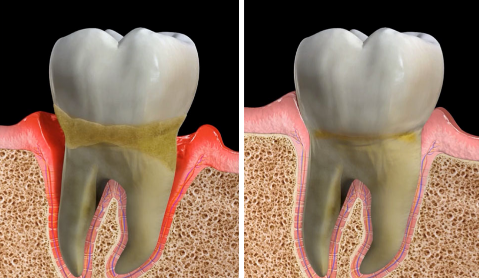 Periodontia