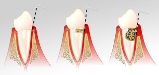 Periodontia